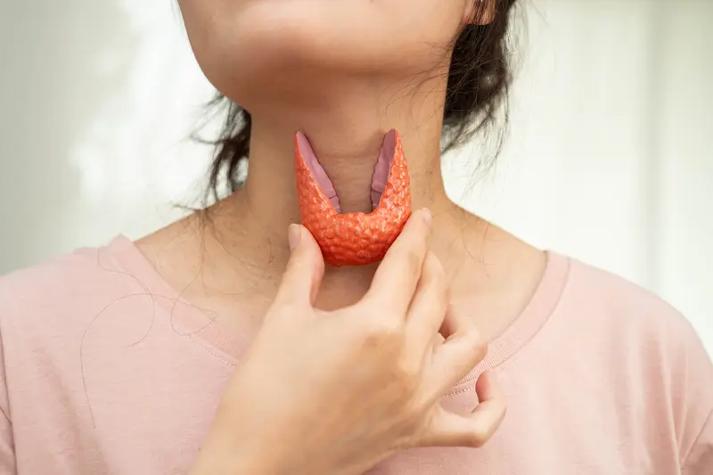 Hyperthyroidism
