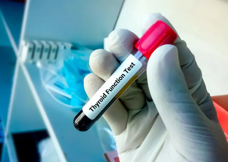 Анализы на гормоны щитовидной железы в Турции