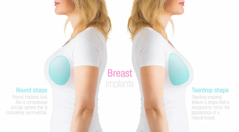 Breast Implants