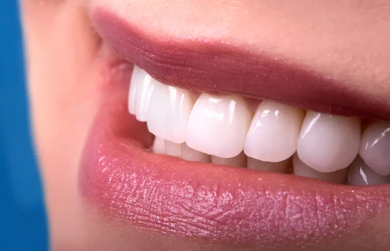 Cosmetic Dentistry Services
