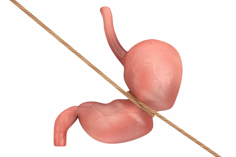 Gastric Band Cost Turkey