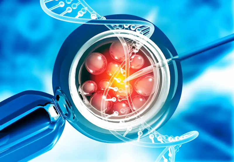 In Vitro Fertilization IVF