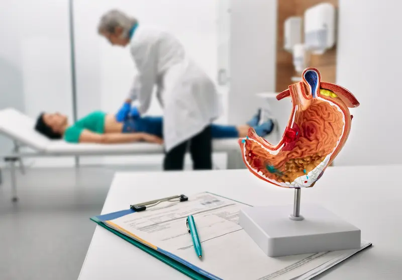 Консультация перед резекцией желудка в Турции: на переднем плане модель желудка, в то время как врач осматривает пациента на фоне.