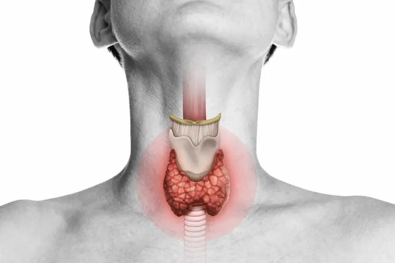 Thyroidectomy in Turkey