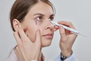 Блефаропластика В Турции