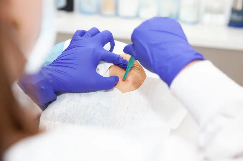 Biopsy Cost in Turkey