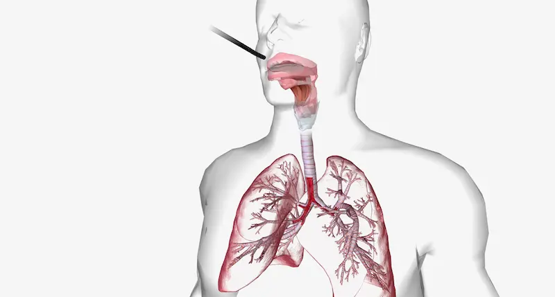 Bronchoscopic Biopsy Cost