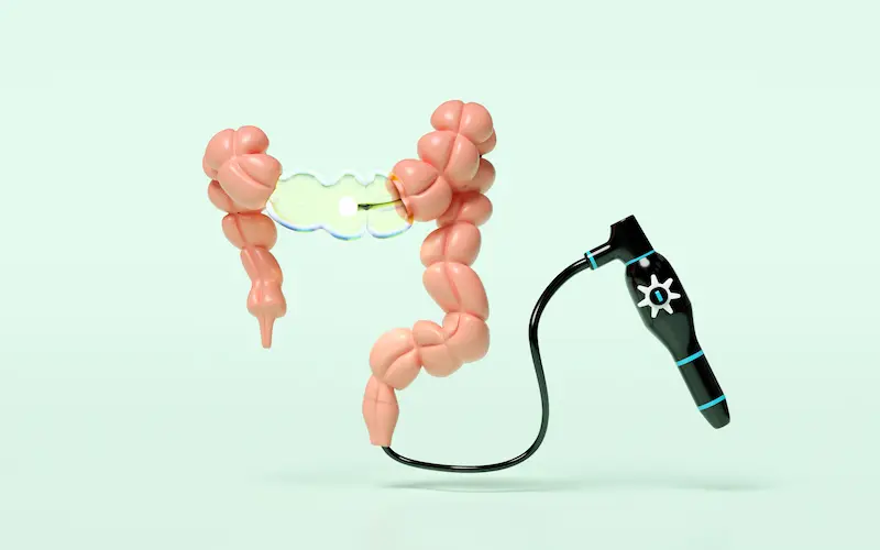 Колоноскопия в Турции