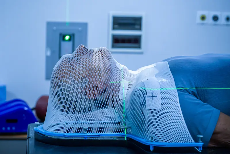 Radiotherapy Radiation Oncology