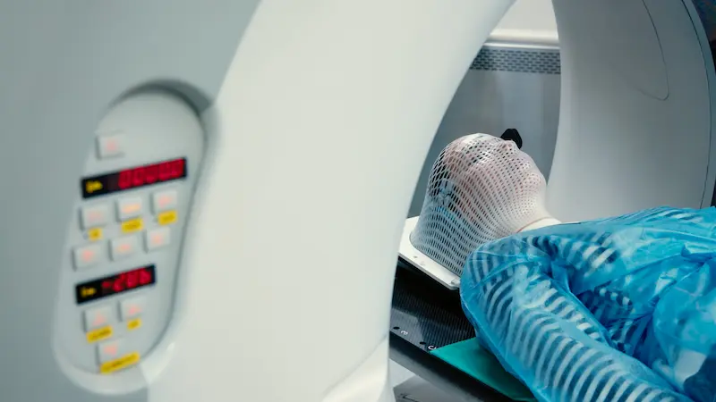 Radiation Therapy for Brain Tumor