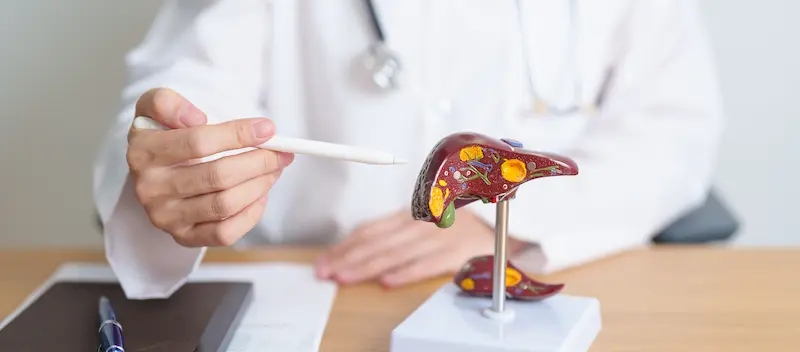 استشارة الطبيب قبل زراعة الكبد في تركيا