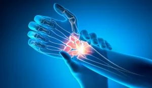 جراحة المعصم في تركيا