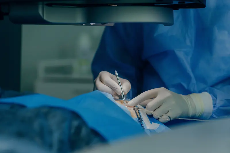 Лазерная коррекция зрения ЛАСИК: хирург-офтальмолог проводит операцию на глазу пациента.