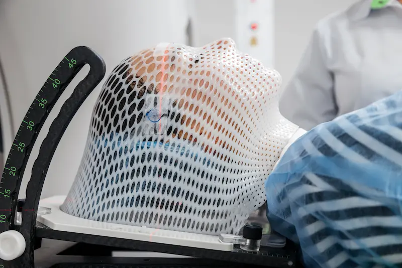 Лучевая терапия опухоли головного мозга в Турции