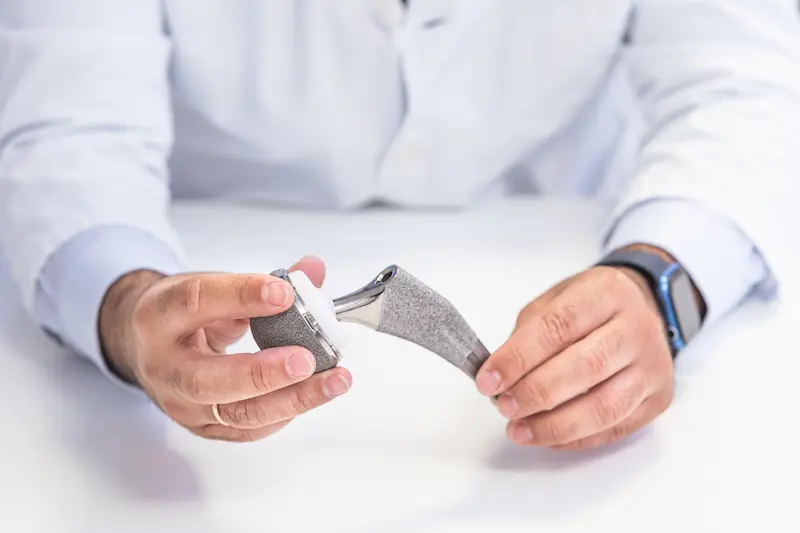 Стоимость эндопротезирования тазобедренного сустава в Турции: хирург держит в руках компоненты современного протеза.