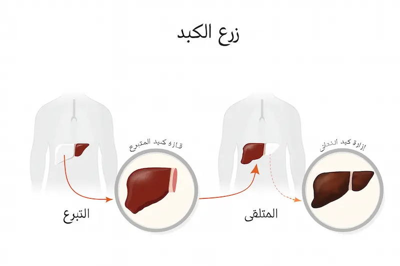 زراعة الكبد