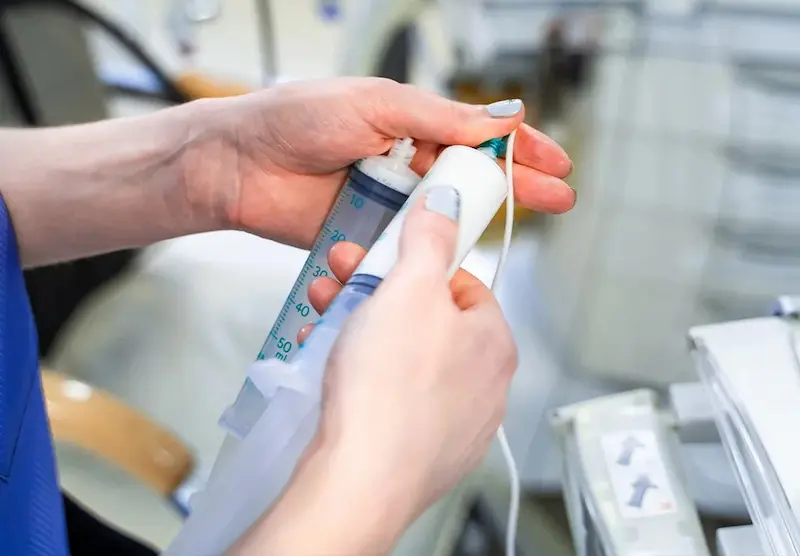 عملية فغر المعدة بالمنظارعبر الجلد (PEG)