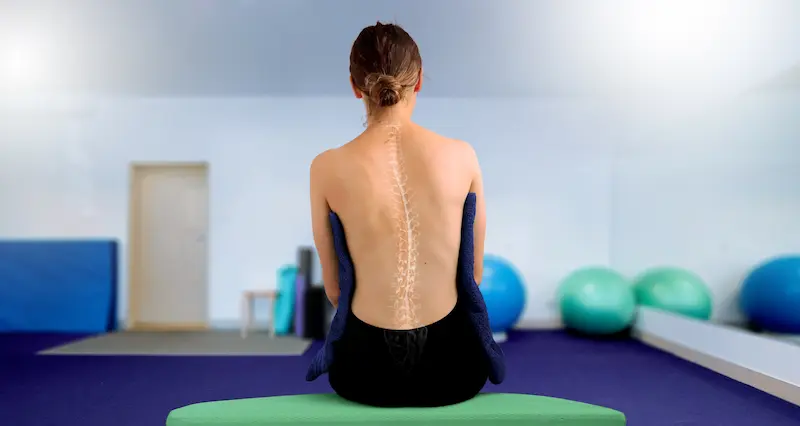 Лечение сколиоза в Турции