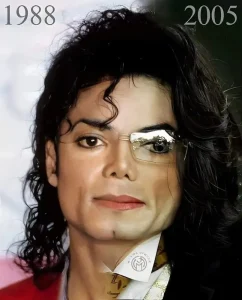 Michael Jackson Plastic Surgery